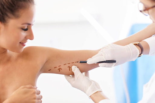 How Much Does an Arm Lift Cost in Austin, Texas?