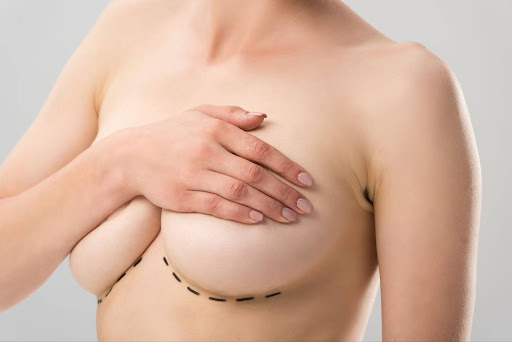 How Much Does a Breast Lift Cost in Austin, Texas?