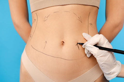 How Much Does a Mini Abdominoplasty Cost in Austin, Texas?